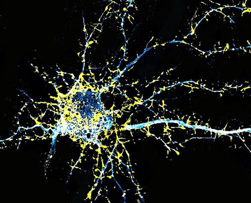 Researchers Develop an LSD Analogue With Potential for Treating Schizophrenia